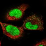 ECT2 Antibody in Immunocytochemistry (ICC/IF)