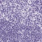Cytokeratin 12 Antibody in Immunohistochemistry (IHC)