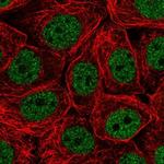 CHTF18 Antibody in Immunocytochemistry (ICC/IF)