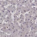 PKP2 Antibody in Immunohistochemistry (IHC)