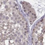 PKP2 Antibody in Immunohistochemistry (IHC)