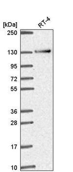 RBM10 Antibody in Western Blot (WB)