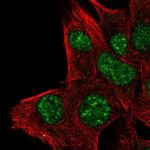 PLA1A Antibody in Immunocytochemistry (ICC/IF)