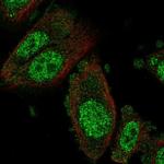 NFX1 Antibody in Immunocytochemistry (ICC/IF)