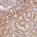 COX14 Antibody in Immunohistochemistry (IHC)