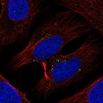 TXK Antibody in Immunocytochemistry (ICC/IF)