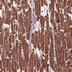 MYL3 Antibody in Immunohistochemistry (IHC)