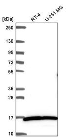 MYL3 Antibody in Western Blot (WB)