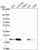 ZNF9 Antibody in Western Blot (WB)