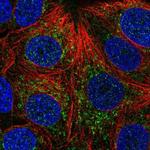 CHCHD4 Antibody in Immunocytochemistry (ICC/IF)