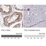 POLI Antibody