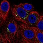 POMT1 Antibody in Immunocytochemistry (ICC/IF)