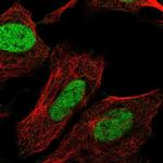 CHTF8 Antibody in Immunocytochemistry (ICC/IF)