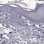 SYNPO2 Antibody in Immunohistochemistry (IHC)