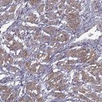 SYNPO2 Antibody in Immunohistochemistry (IHC)