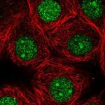 GMPR2 Antibody in Immunocytochemistry (ICC/IF)