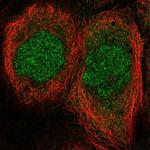 MESP1 Antibody in Immunocytochemistry (ICC/IF)