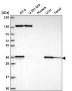 SC5D Antibody in Western Blot (WB)