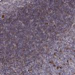 Cyclin F Antibody in Immunohistochemistry (IHC)