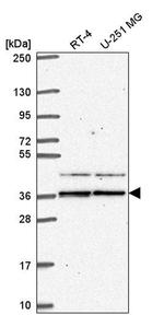 SPRY1 Antibody in Western Blot (WB)