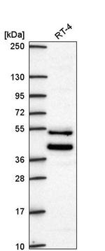 ZNF621 Antibody in Western Blot (WB)