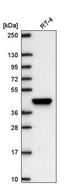 LHX8 Antibody in Western Blot (WB)