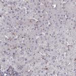 RABGAP1 Antibody in Immunohistochemistry (IHC)