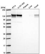 RABGAP1 Antibody in Western Blot (WB)