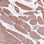 ITGB1BP3 Antibody in Immunohistochemistry (IHC)