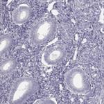 Septin-14 Antibody in Immunohistochemistry (IHC)