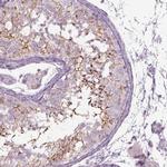 Septin-14 Antibody in Immunohistochemistry (IHC)