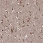 AGPAT1 Antibody in Immunohistochemistry (IHC)