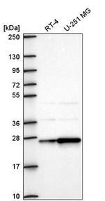 AGPAT1 Antibody in Western Blot (WB)