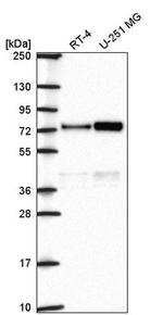ORC2 Antibody in Western Blot (WB)