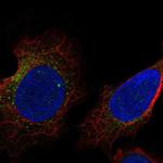 USP27X Antibody in Immunocytochemistry (ICC/IF)