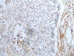 MAGEB5 Antibody in Immunohistochemistry (Paraffin) (IHC (P))