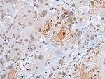 HOXC4 Antibody in Immunohistochemistry (Paraffin) (IHC (P))