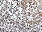 IWS1 Antibody in Immunohistochemistry (Paraffin) (IHC (P))