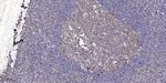 ASF1B Antibody in Immunohistochemistry (Paraffin) (IHC (P))