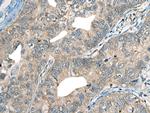 CDADC1 Antibody in Immunohistochemistry (Paraffin) (IHC (P))