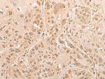 CISD1 Antibody in Immunohistochemistry (Paraffin) (IHC (P))