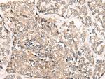 SLC5A8 Antibody in Immunohistochemistry (Paraffin) (IHC (P))