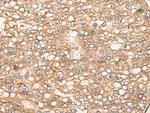 SLC5A8 Antibody in Immunohistochemistry (Paraffin) (IHC (P))