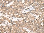 ZXDA Antibody in Immunohistochemistry (Paraffin) (IHC (P))