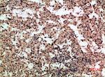 PF4 Antibody in Immunohistochemistry (Paraffin) (IHC (P))