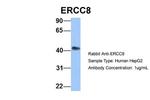 ERCC8 Antibody in Western Blot (WB)