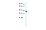 HOXB1 Antibody in Western Blot (WB)