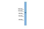 MYT1 Antibody in Western Blot (WB)