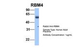 RBM4 Antibody in Western Blot (WB)