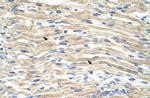 EXOSC6 Antibody in Immunohistochemistry (Paraffin) (IHC (P))